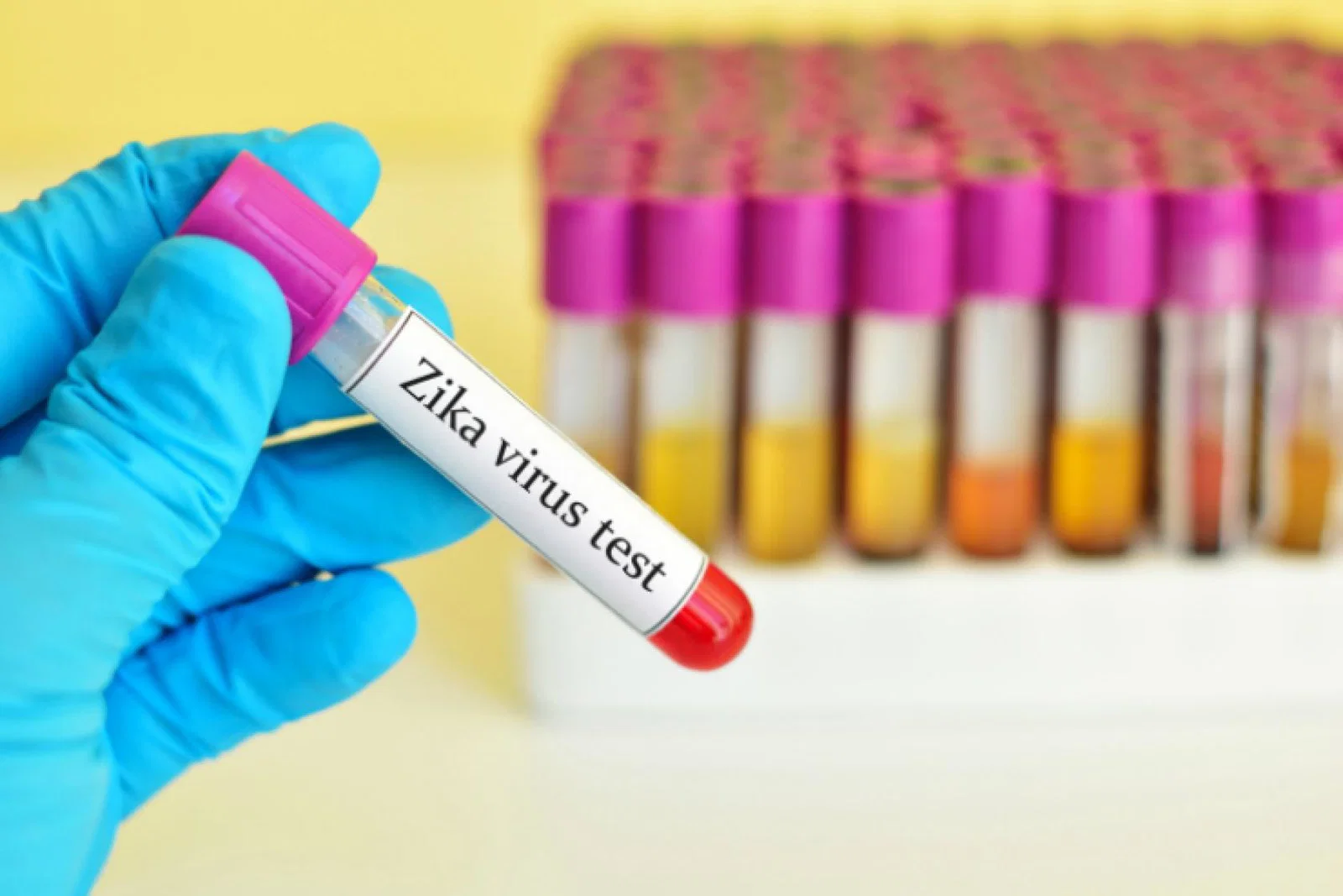 Zika image web.jpg